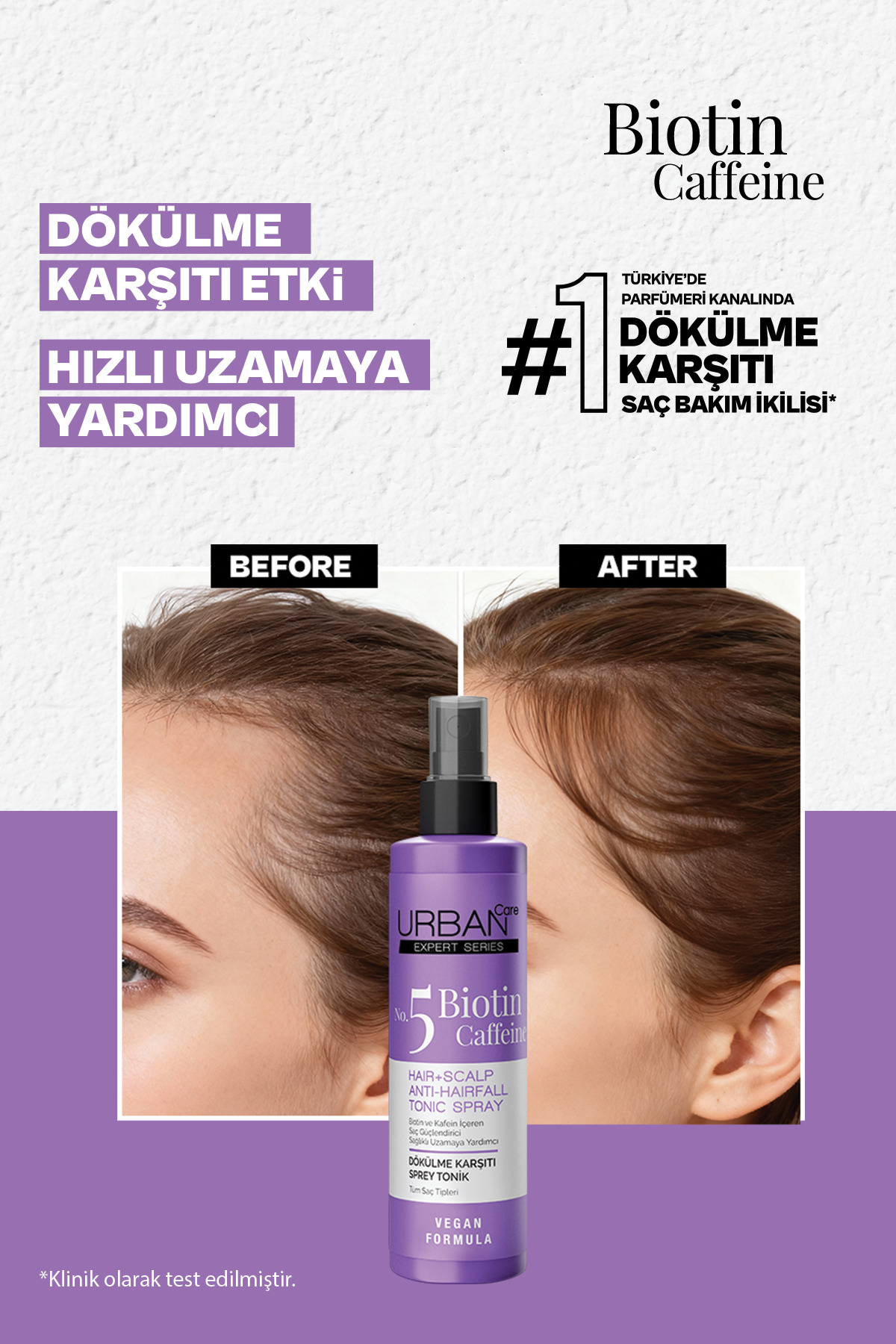 تونیک ضد ریزش مو بیوتین و کافئین سری اکسپرت 200 میلی لیتر  اربن کر Urban Care