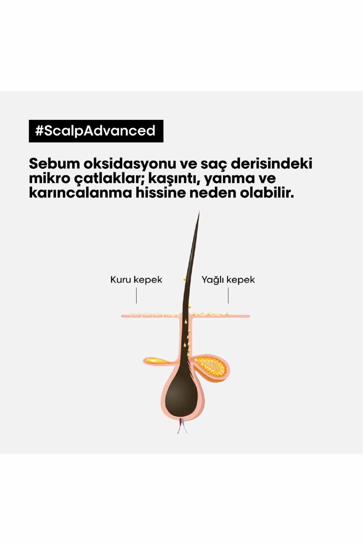 L'oreal Professionnel شامپو حرفه ای ضد شوره پیشرفته Serie Expert 500 میلی لیتر