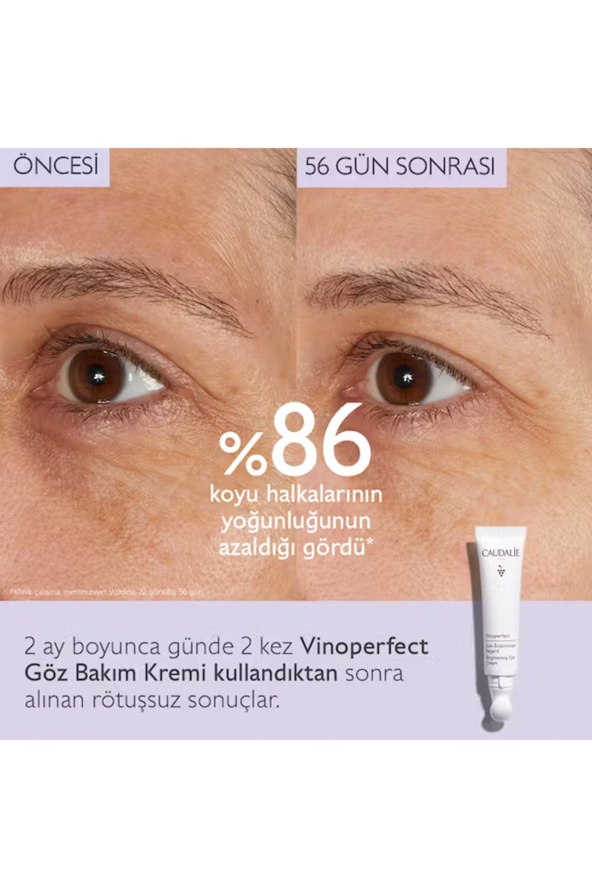 کرم دور چشم حلقه تیره VINOPERFECT وگان مراقبت از براق 15ML Caudalie