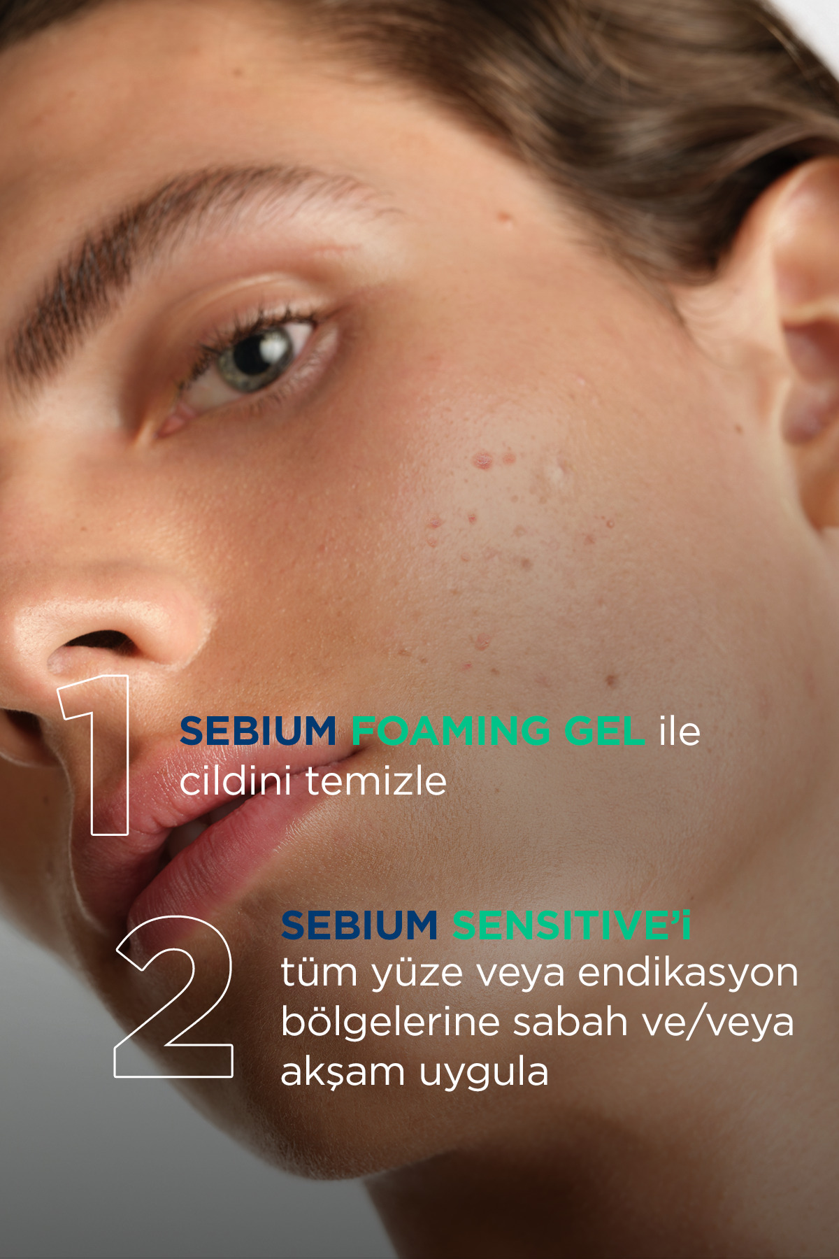 کرم مرطوب کننده و ضد آکنه مدل Sensitive با حجم 30 میل بایودرما Bioderma