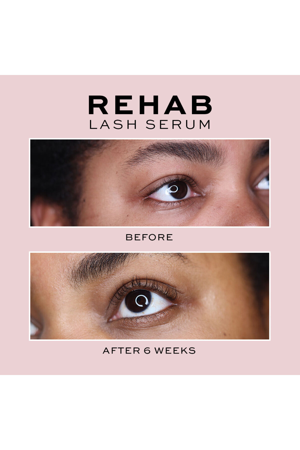 سرم ابرو و مژه مراقبت از شلاق REHAB 3 میل Revolution