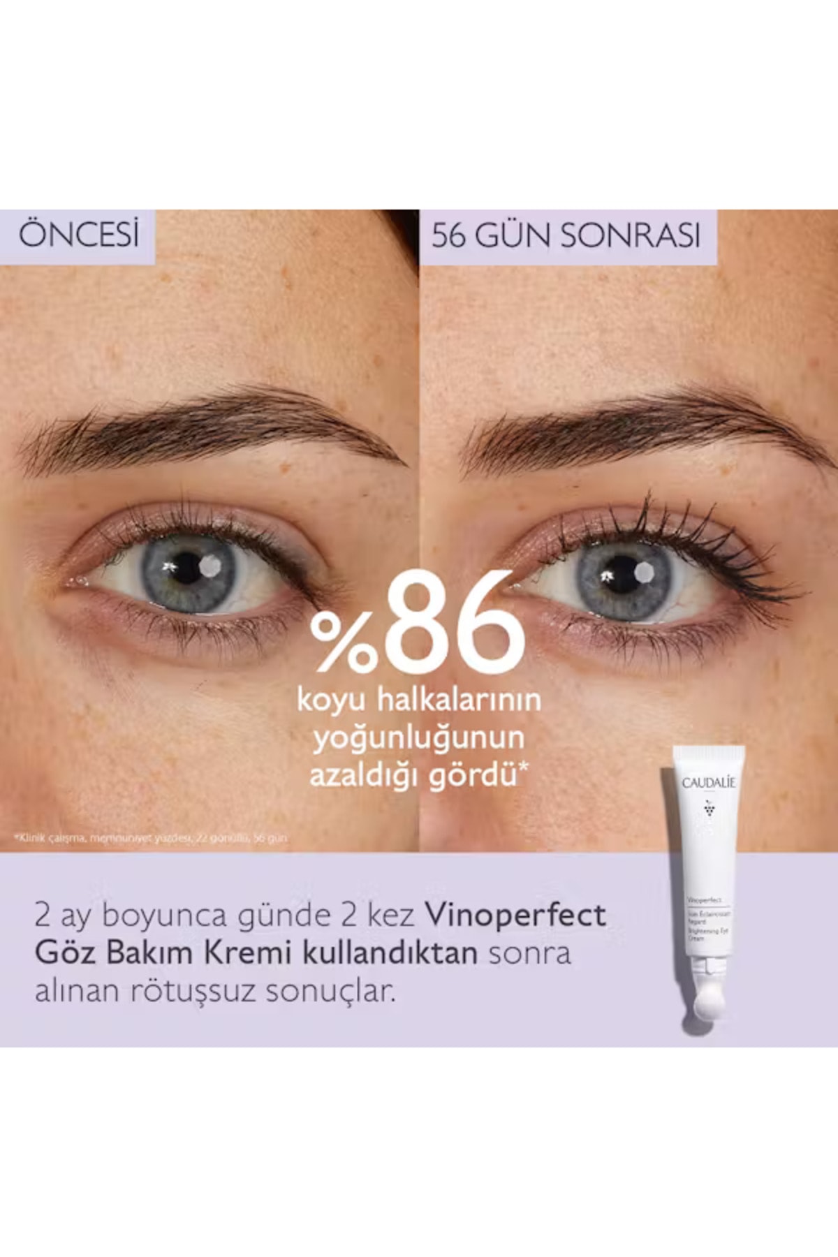 کرم دور چشم حلقه تیره VINOPERFECT وگان مراقبت از براق 15ML Caudalie
