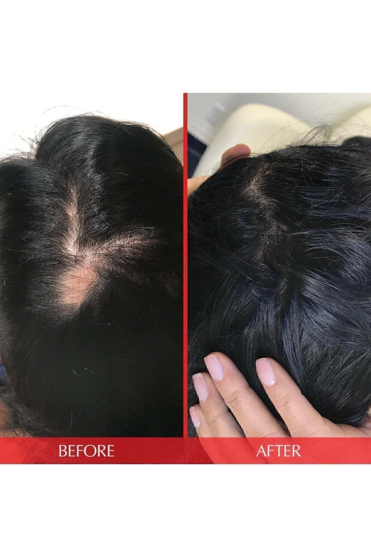 ویتامین مو کپسول وگان فرمول 30 پیشرفته HAIRtamin