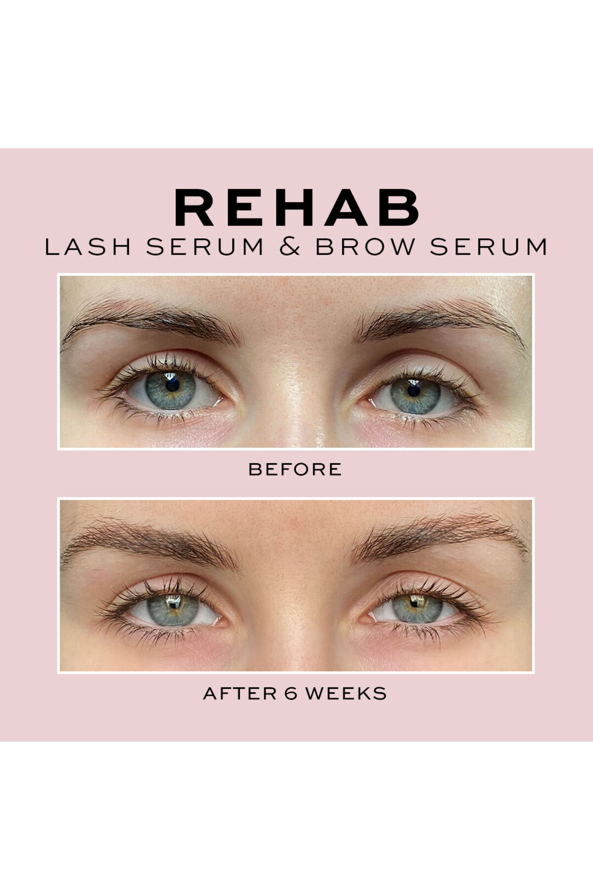 سرم ابرو و مژه مراقبت از شلاق REHAB 3 میل Revolution