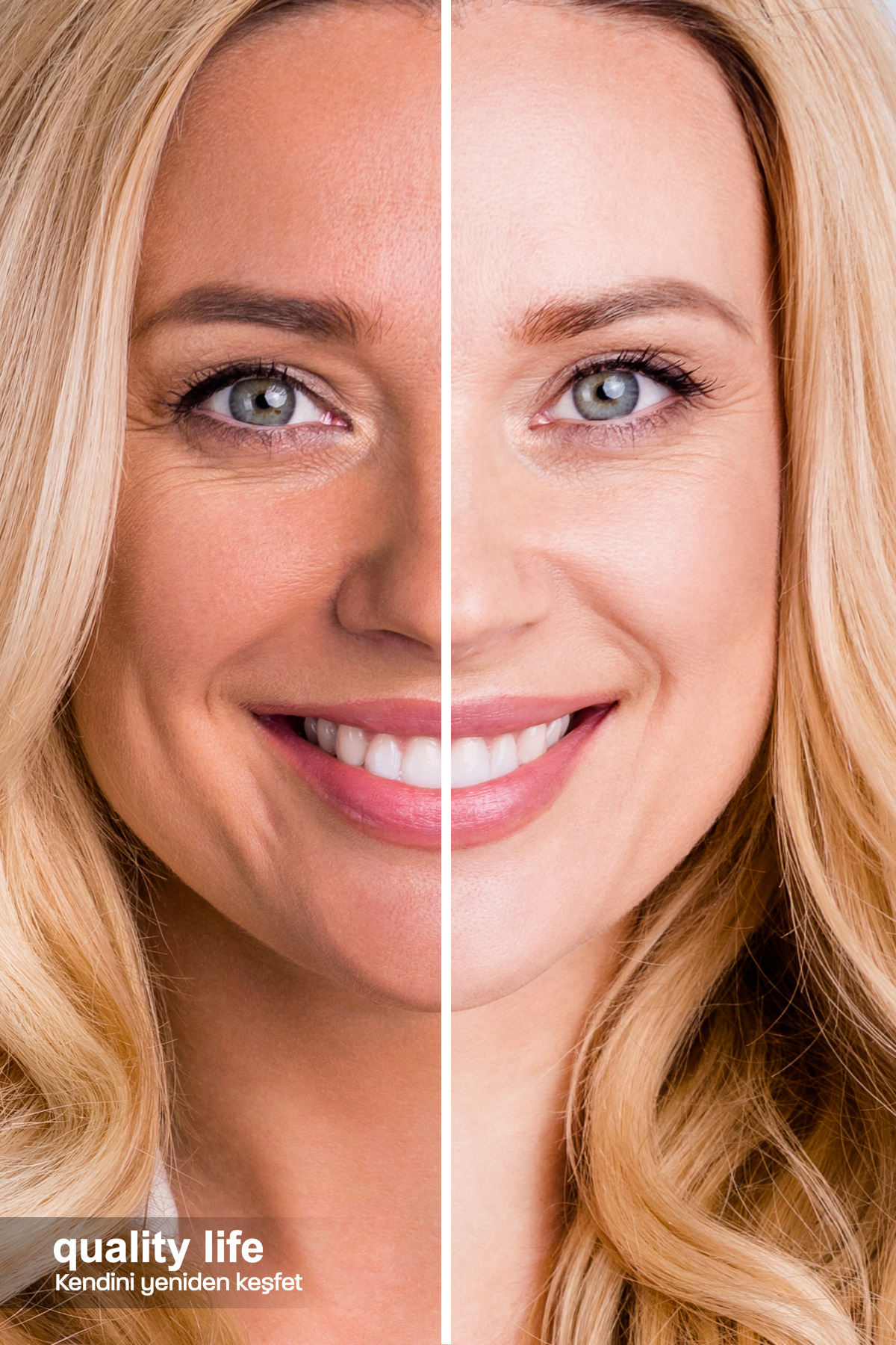 کرم صورت سفید کننده پوست زیر بغل بیکینی ناحیه آرنج منطقه خاص تناسلی ویژه Quality Life
