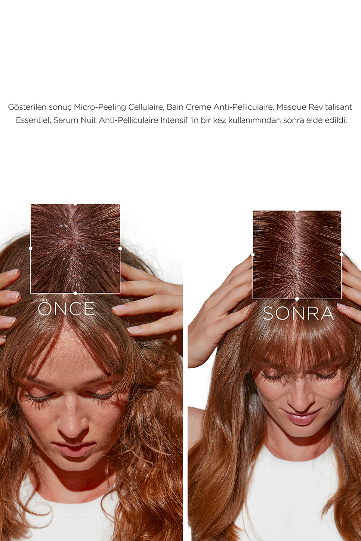 ماسک موی ضد شوره فوق العاده SYMBIOSE INTENSIVE 200 میلی لیتر کراستاس Kerastase