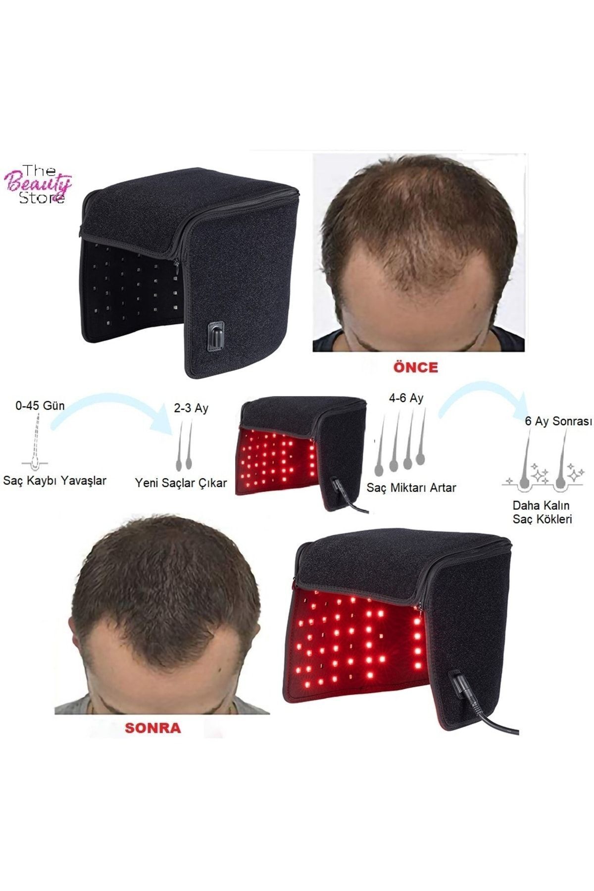 ست مراقبت مو ماسک از درمانی دستگاه لیزر نور مادون قرمز تقویت کننده رشد اورجینال TheBeautyStore