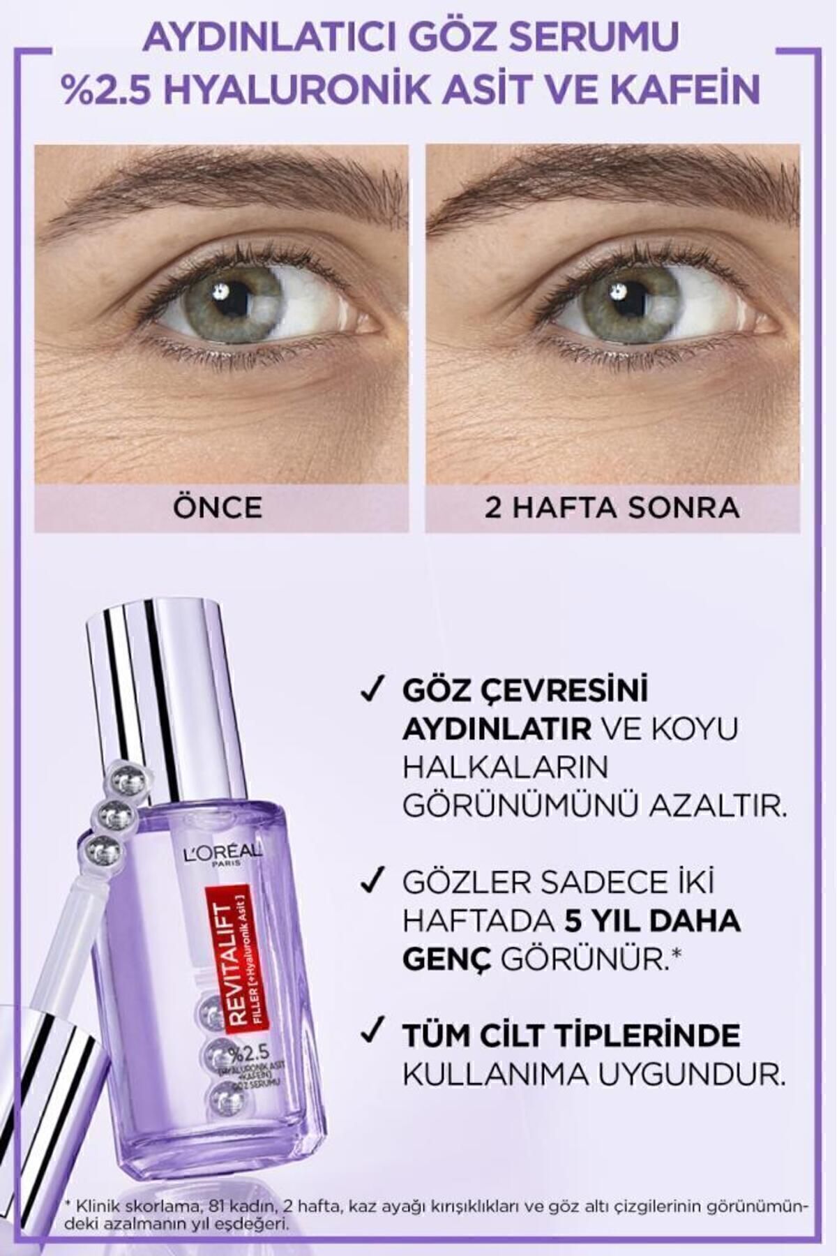 ریمل مجموعه زیبایی: تلسکوپی در سرمی موهای دیگر سرم چشم L'Oreal Paris