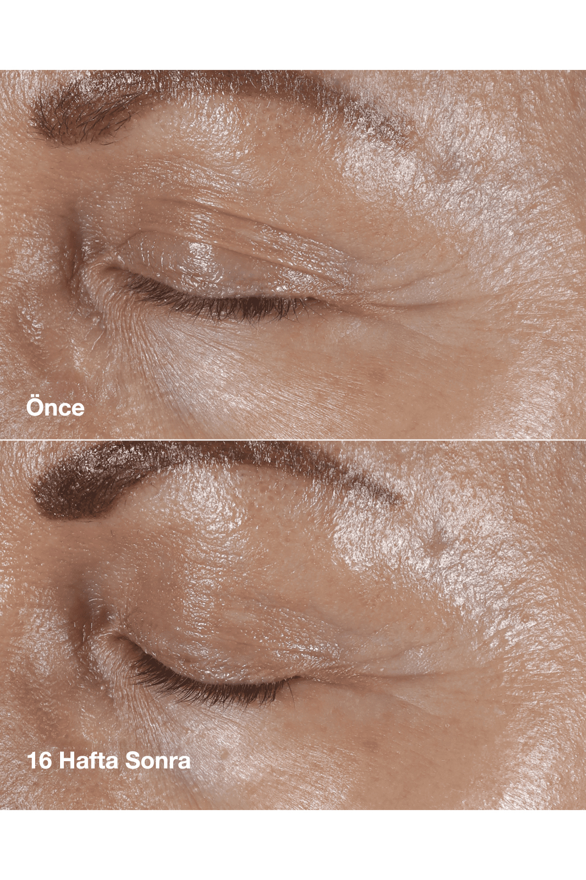 کرم چشم ضدچروک اصلاح‌کننده هوشمند کلینیک برای چشمان جوانتر کلینیک Clinique