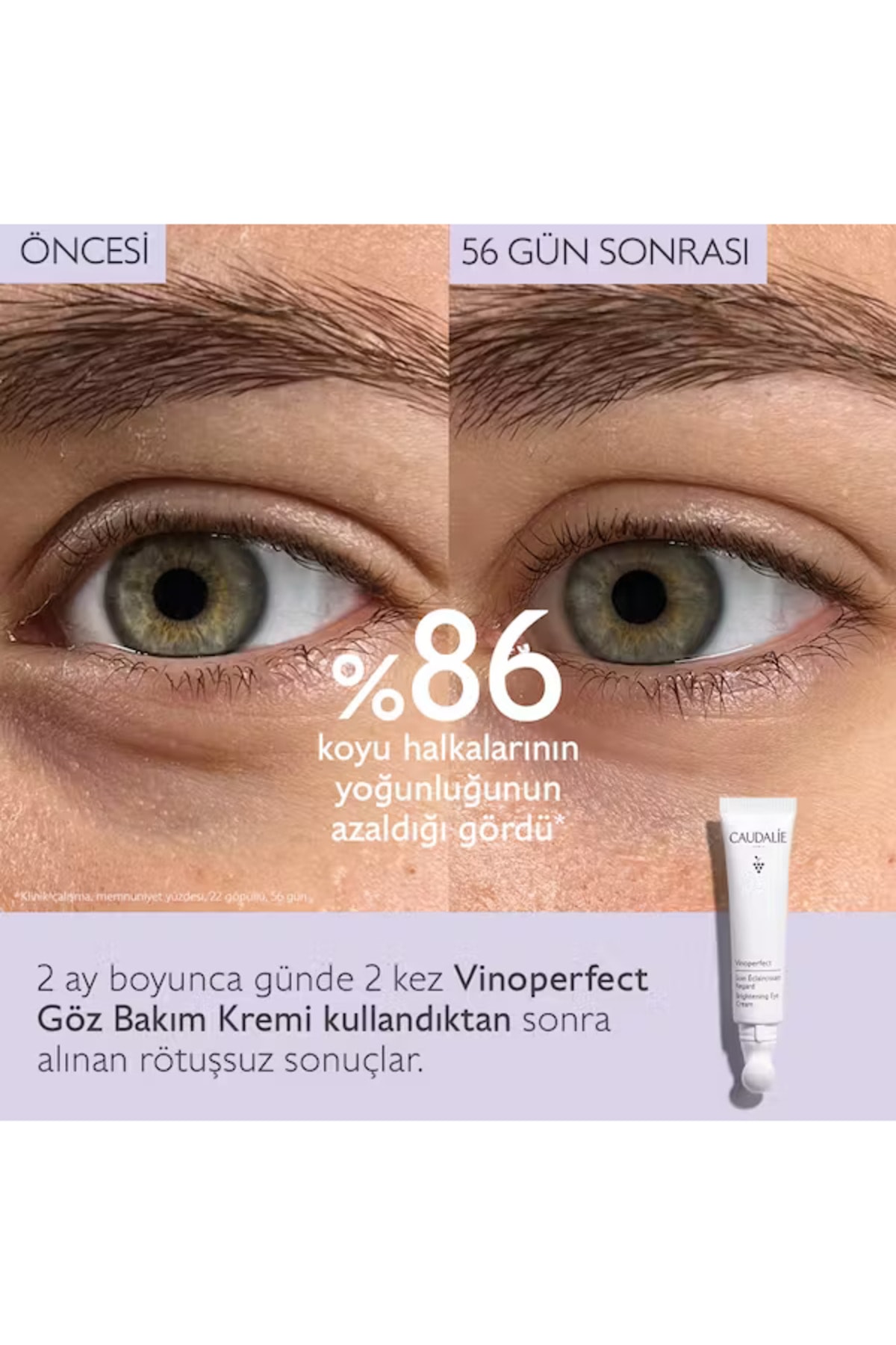 کرم دور چشم حلقه تیره VINOPERFECT وگان مراقبت از براق 15ML Caudalie