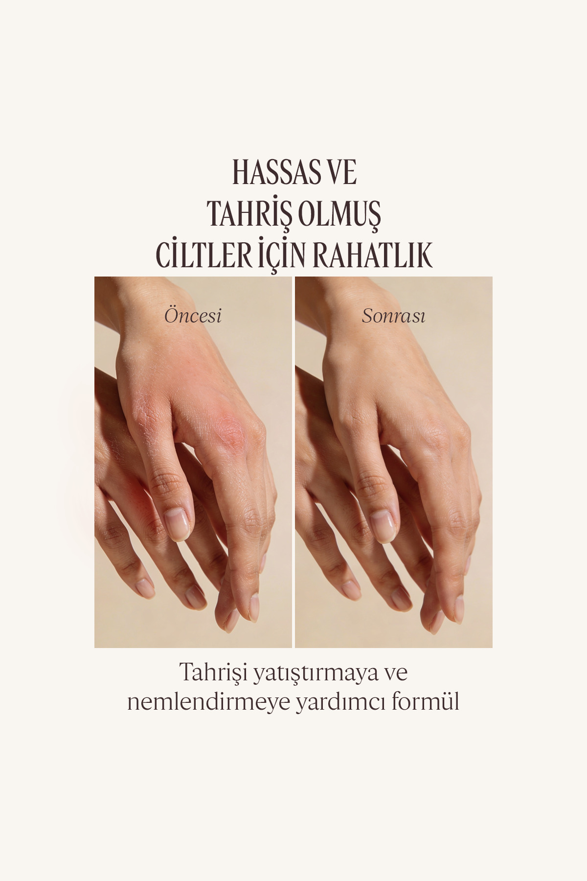 شی باتر کرم دست مرطوب کننده مناسب پوست خشک و حساس