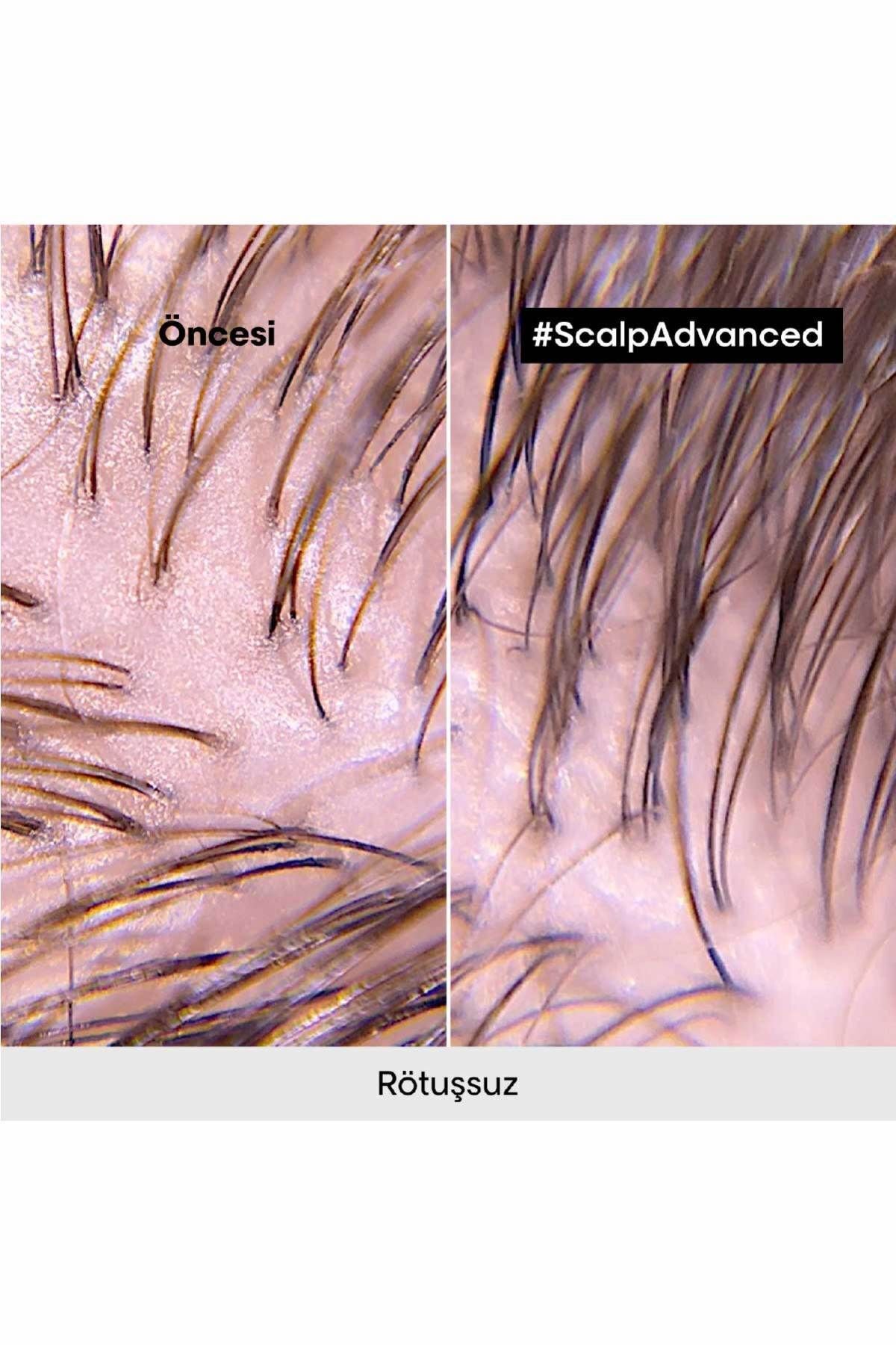 L'oreal Professionnel شامپو حرفه ای ضد چربی پیشرفته موهای سری اکسپرت 500 میلی لیتر