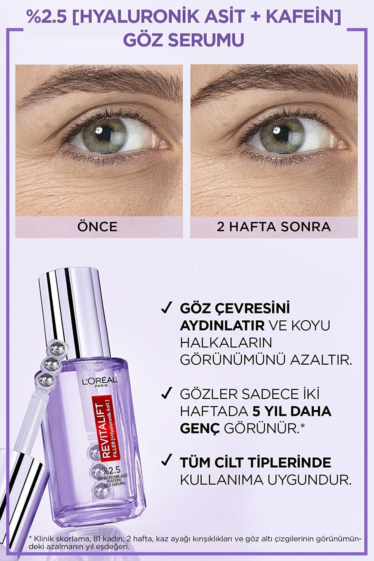 L'Oreal Paris جذابیت‌های پینار دنیز: سرم روشن کننده چشم Revitalift Elephants 20 میلی‌لیتر و ماسکارا تلسکوپیک لیفت