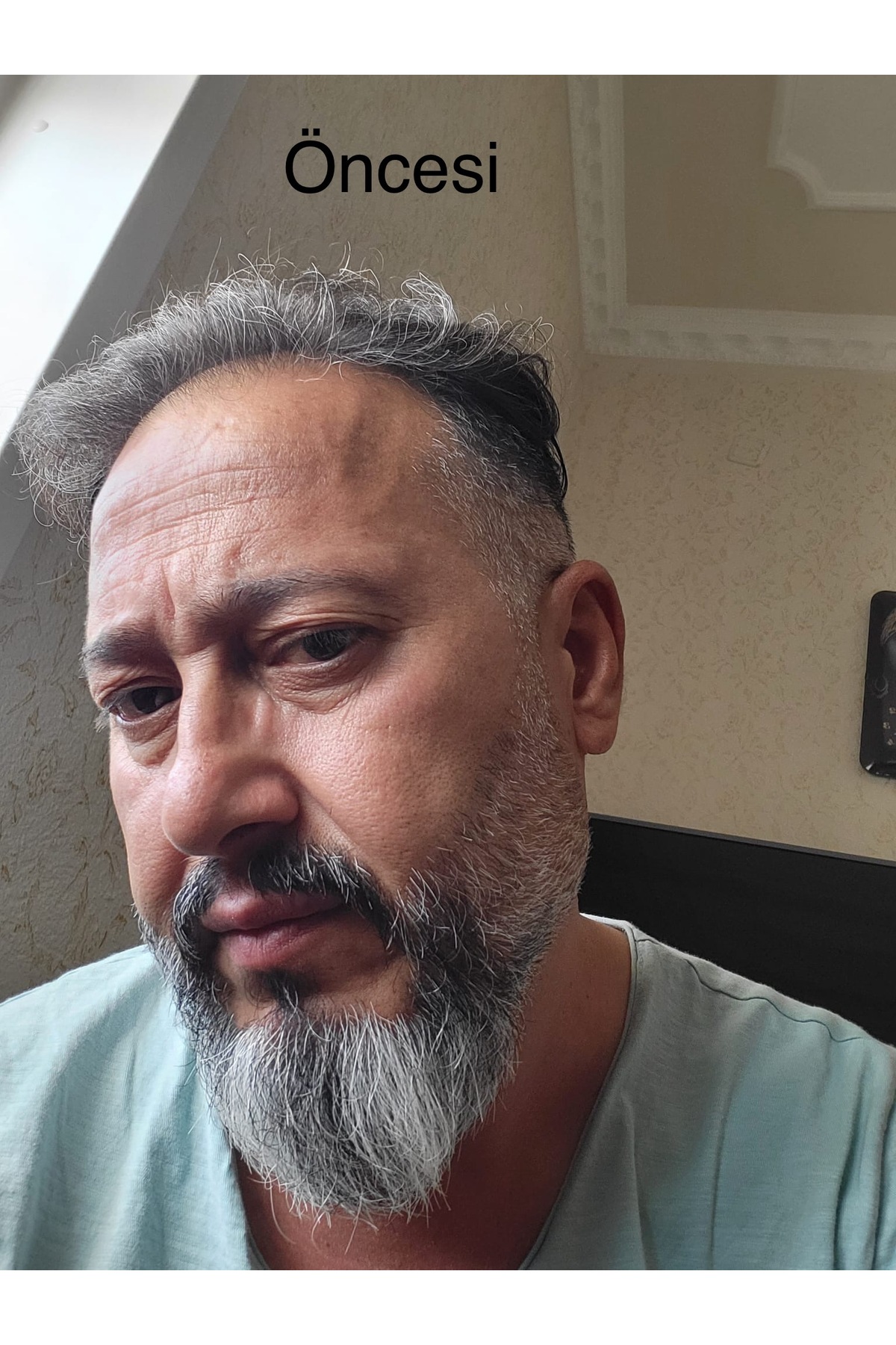 شامپو رنگی مشکی و سفید 400 میلی‌لیتری مناسب برای همه جنسیت‌ها Egş DERMA delete