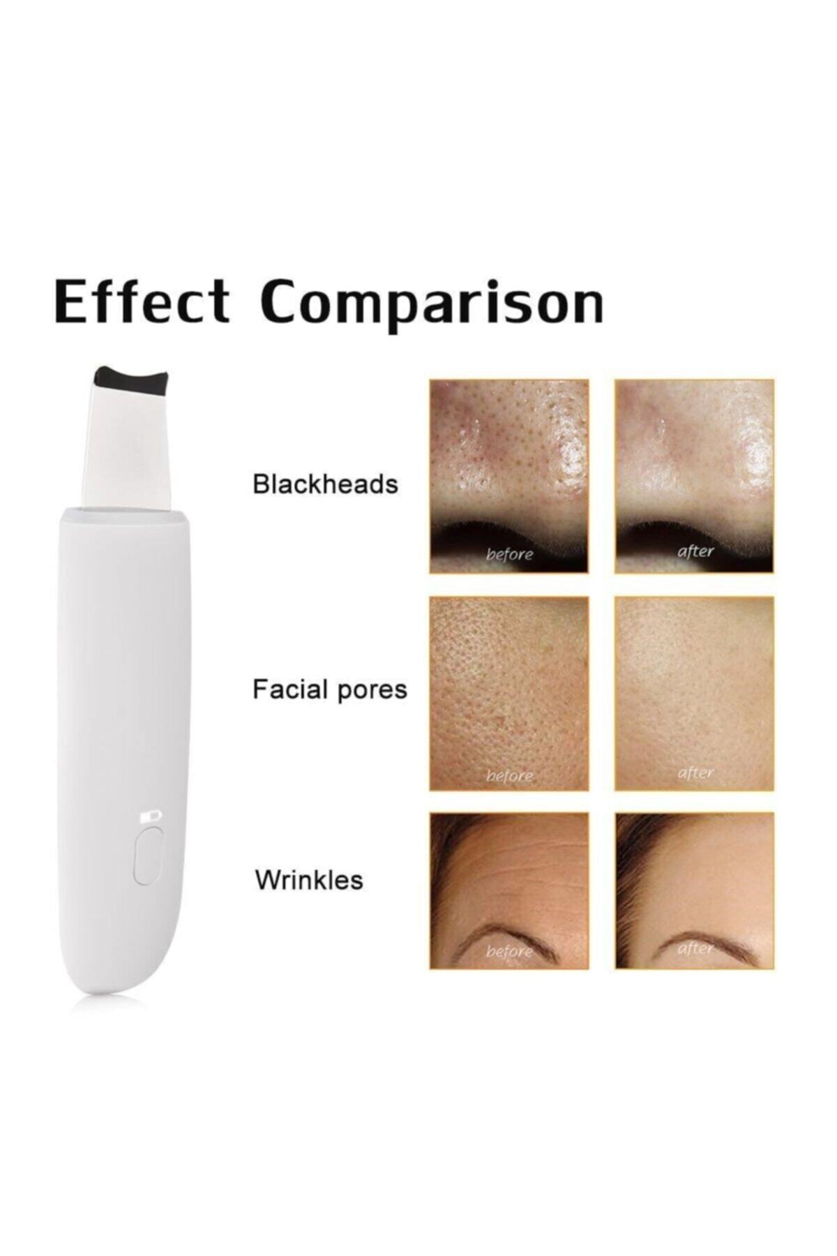دستگاه شستشوی صورت آبگرم اسکرابر جوش سر سیاه اولتراسونیک اورجینال pazariz