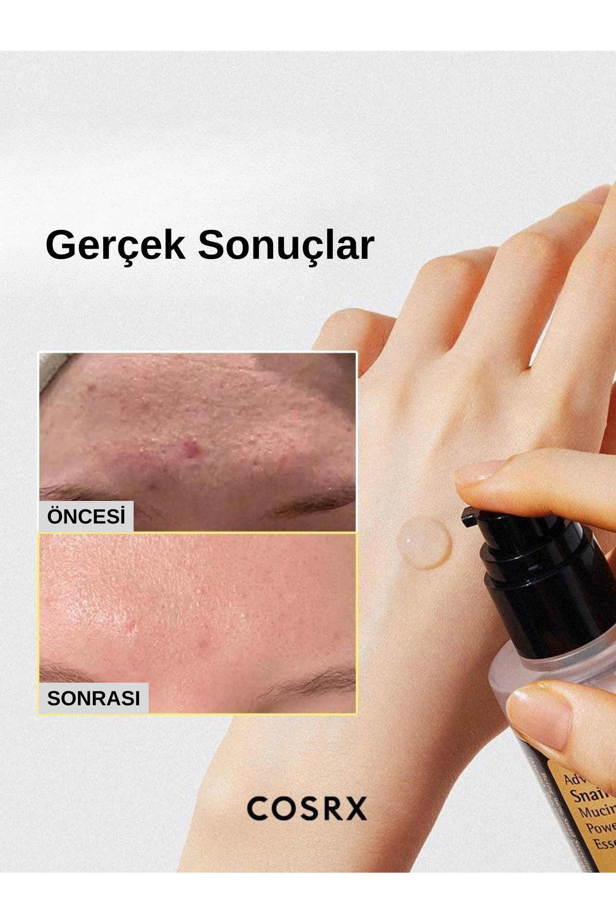 اسانس مرطوب کننده و مغذی با عصاره حلزون کوزارکس CosRX
