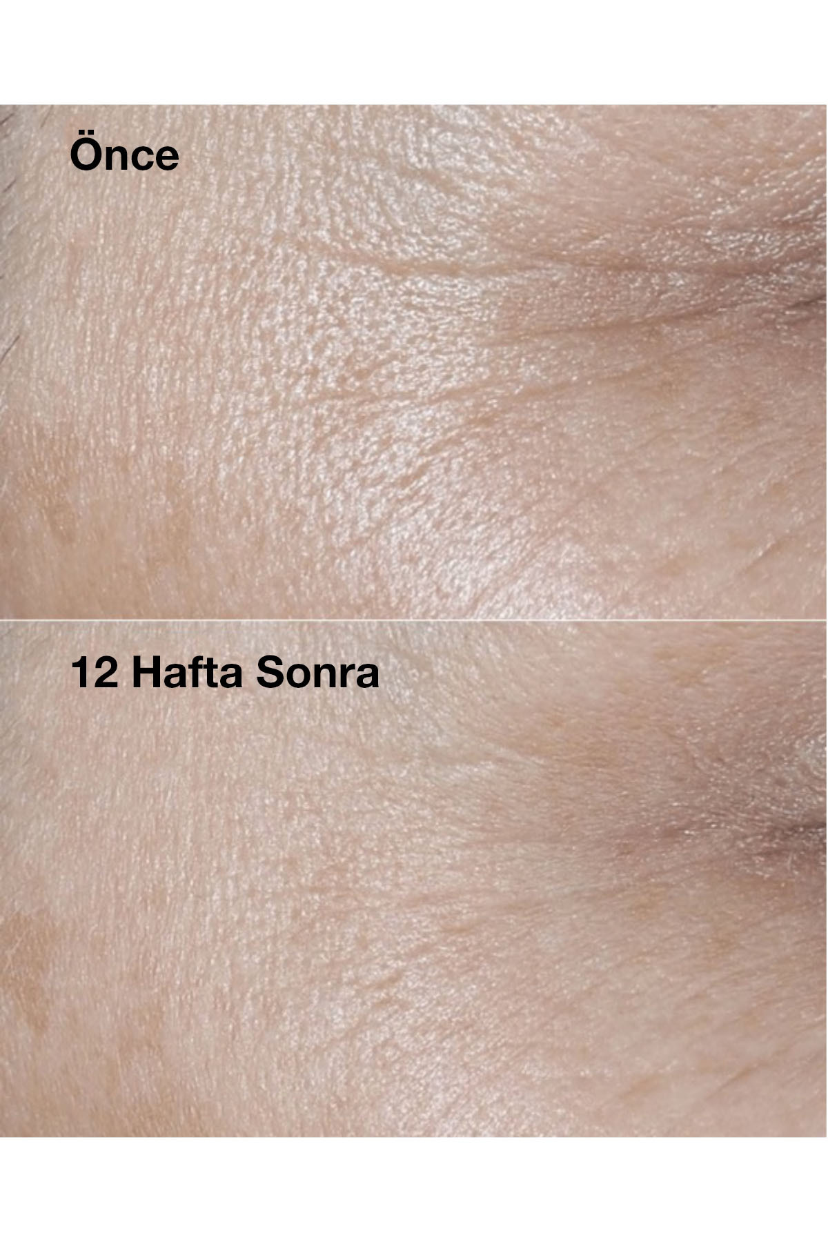 Clinique کرم چهره با SPF 30 و ترمیم کننده هوشمند حجم 50 میلی لیتر