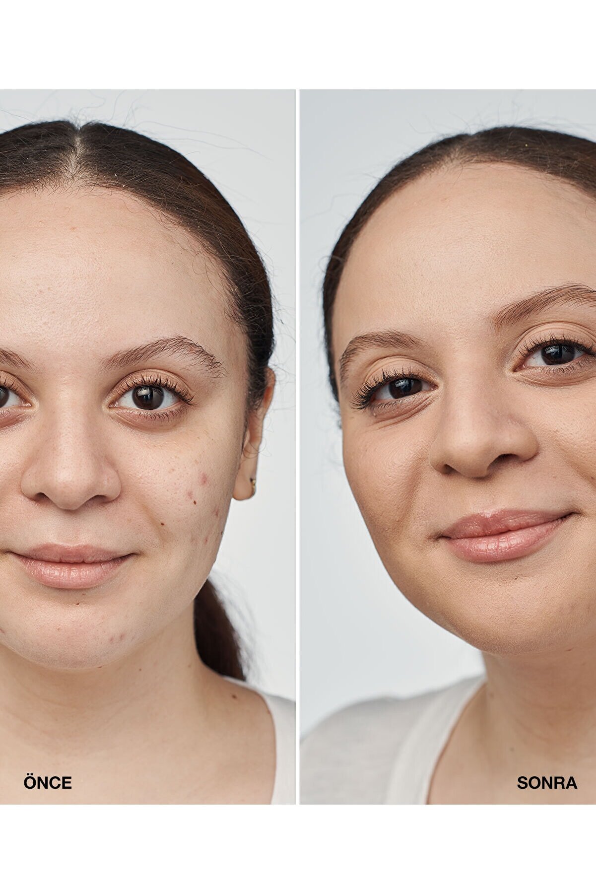 کرم پودر سرمی ایون بتر کلینیکال رنگ بژ شماره SPF 20  Cn 52 کلینیک Clinique