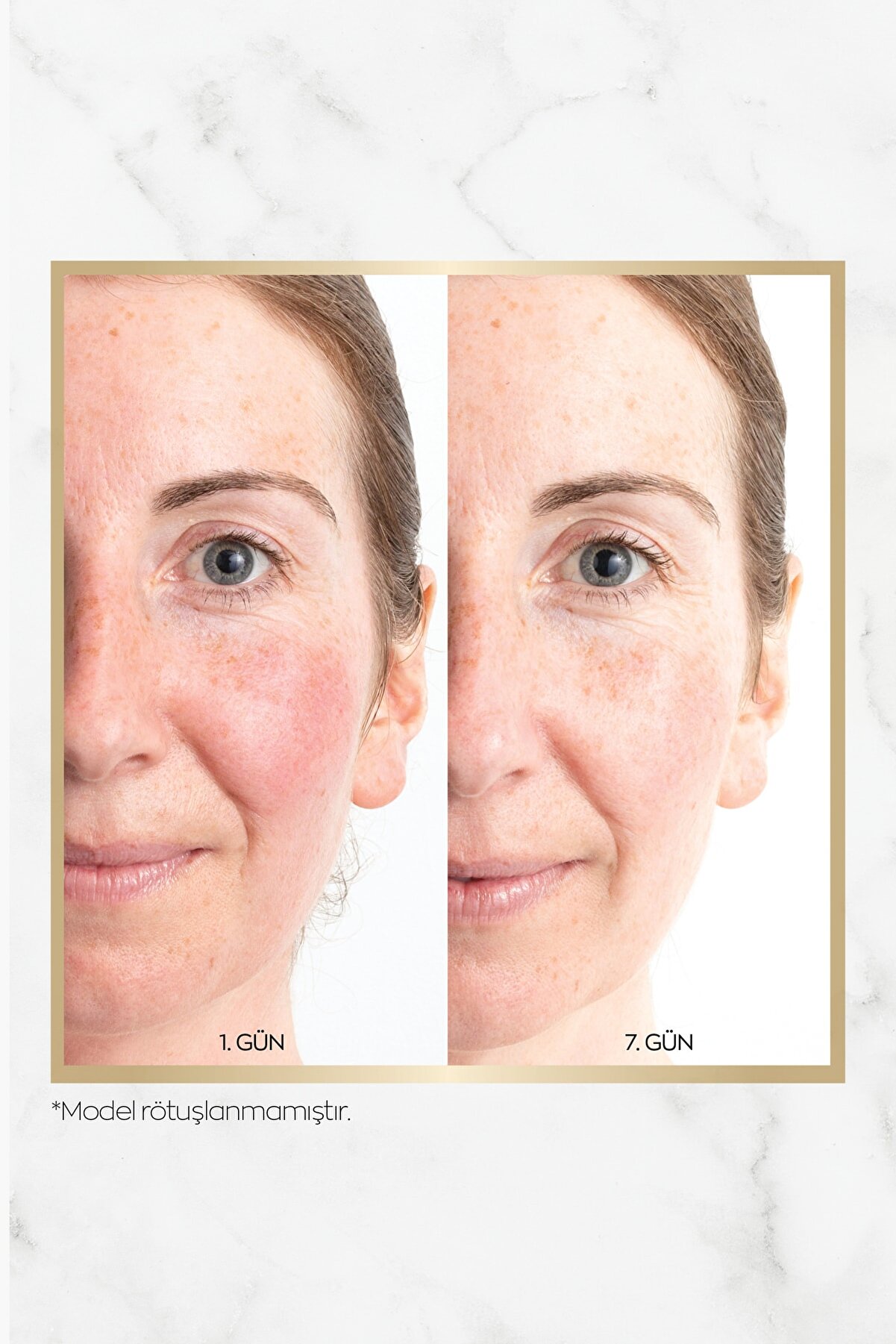 سرم جوانساز قدرتمند پروتینول Anew آون Avon